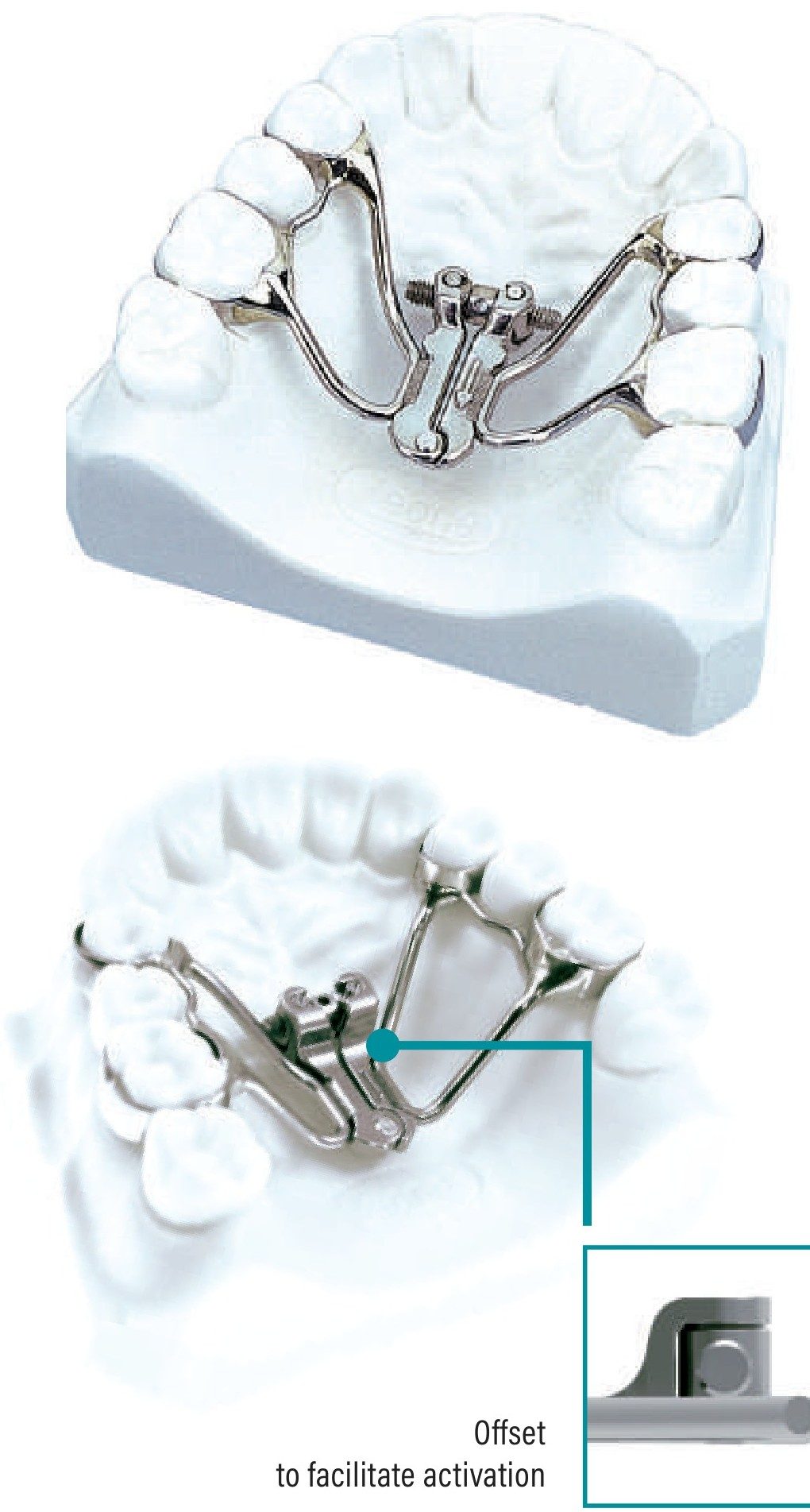 Ragno лепезаст брз експандер A0625